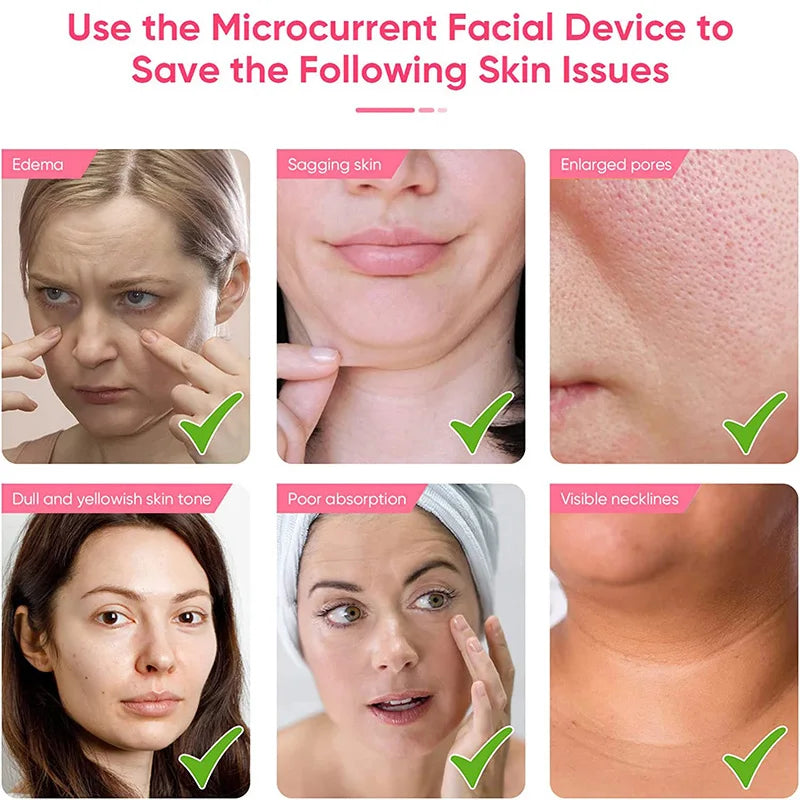 EMS Facial Lifting Massager – Microcurrent Face Roller for Skin Tightening, Anti-Aging & Wrinkle Reduction | Rejuvenating Beauty Device